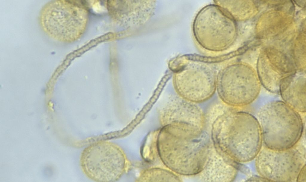 Perichaena depressa?